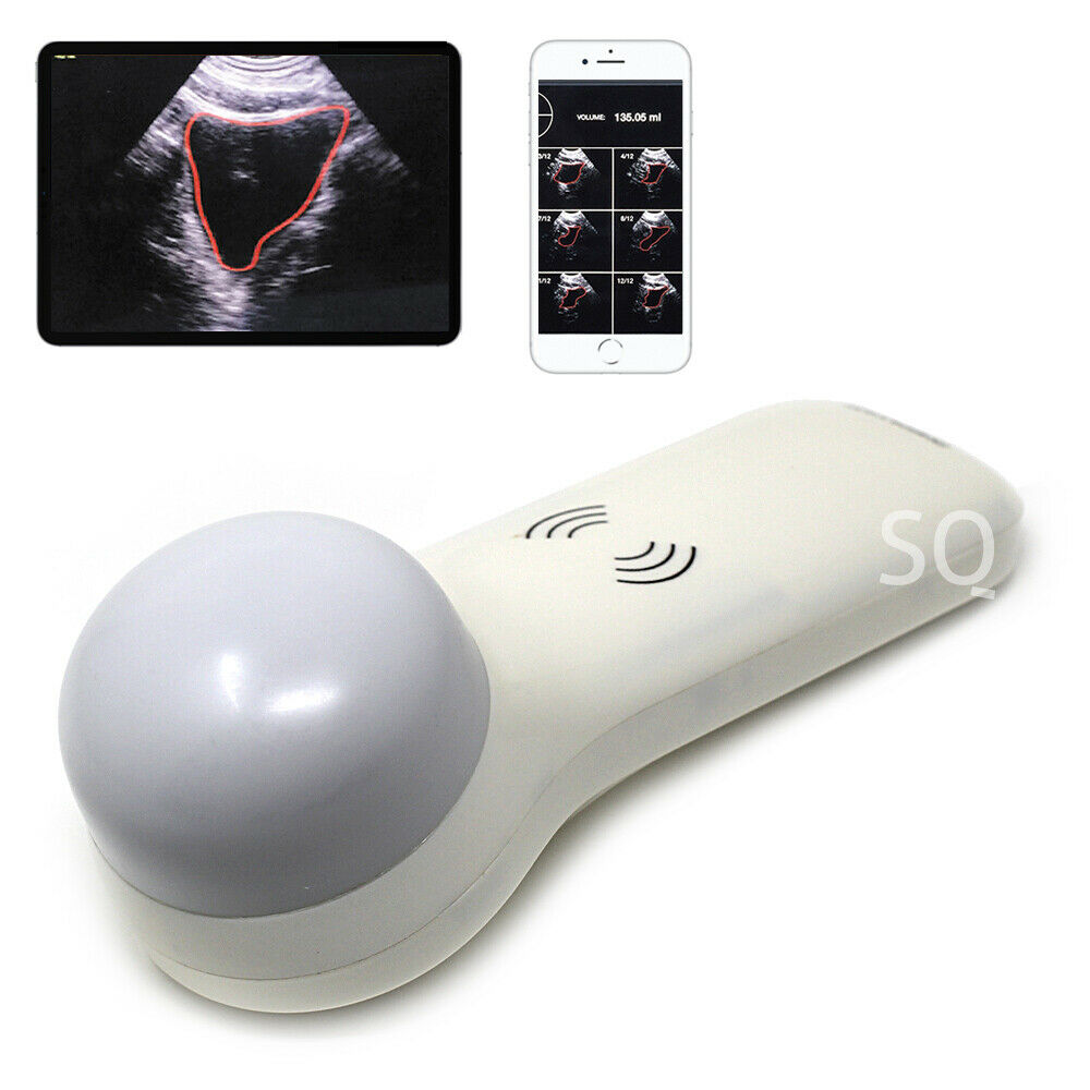 Portable Bladder Probe Scanner - Ultrasound 1 Portable Bladder Probe Scanner - Ultrasound